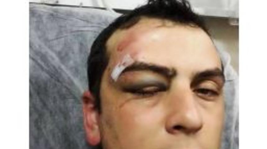 Kediye &Ccedil;arpmamak İ&ccedil;in Canından Oluyordu