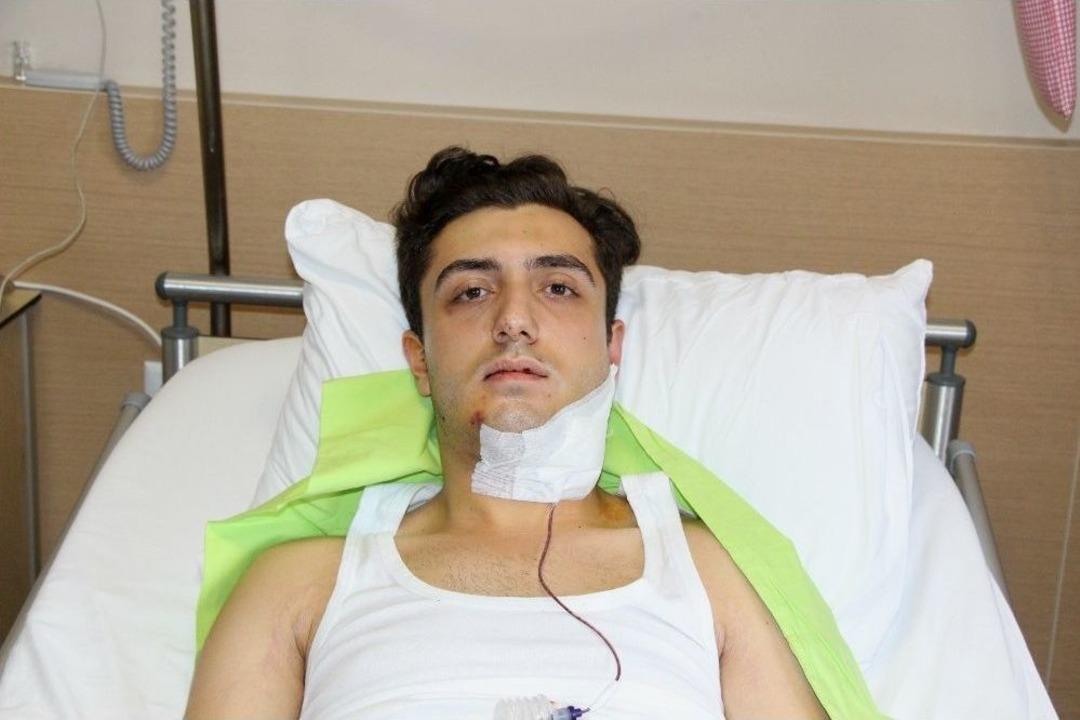 Trafik Tartışmasında Tek Yumrukla &Ccedil;enesini Kıran Şahsın Yakalanmasını İstiyor