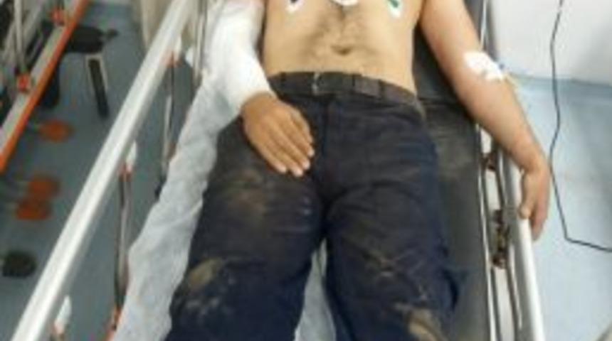 34 Bin 500 Volt Elektriğe Kapıldı, Sağ Kurtuldu