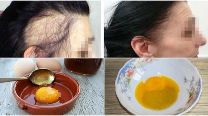 3 Basit Malzemeyle D&ouml;k&uuml;len Sa&ccedil;larınızı Geri Kazanın!