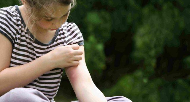 girl with mosquito bite, scratching hand has motion blur