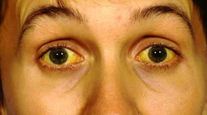 Turpun Faydaları Nelerdir?