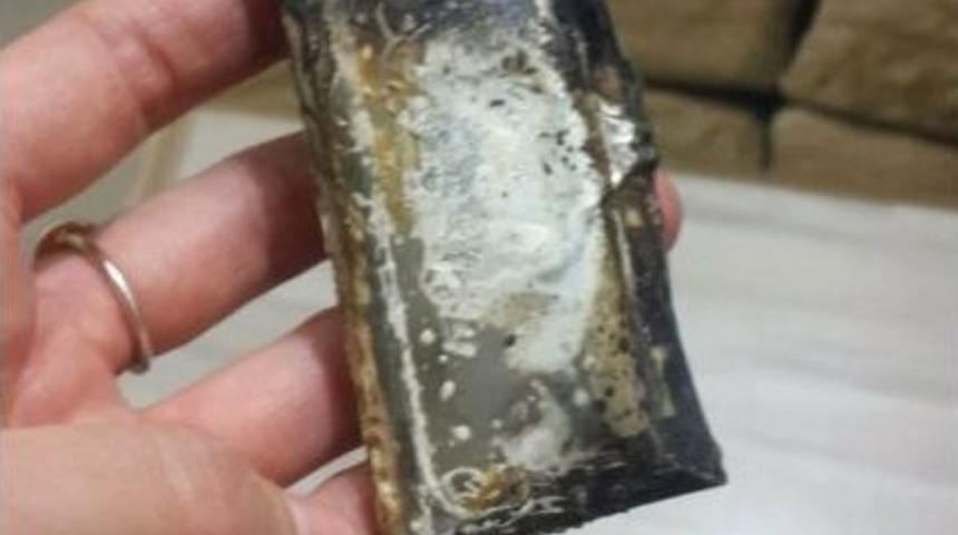 Doktorun Cebindeki Telefon Patladı