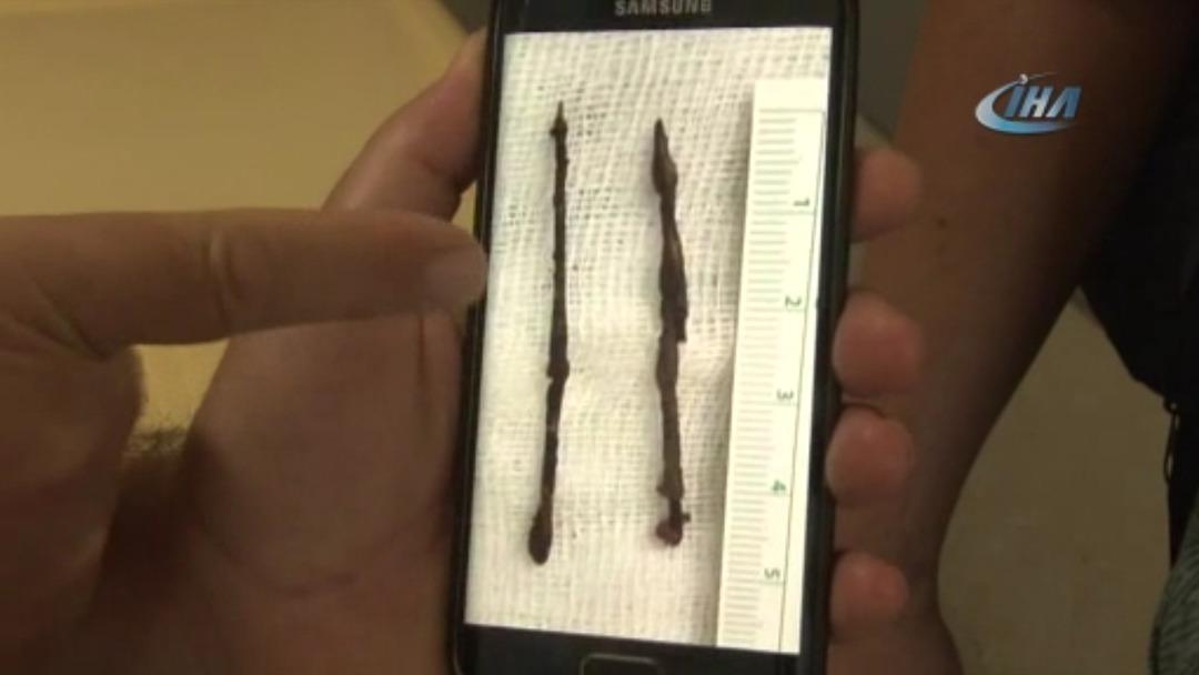 66 yıl sonra ortaya &ccedil;ıkan ger&ccedil;ek doktorları dahi şaşkına &ccedil;evirdi