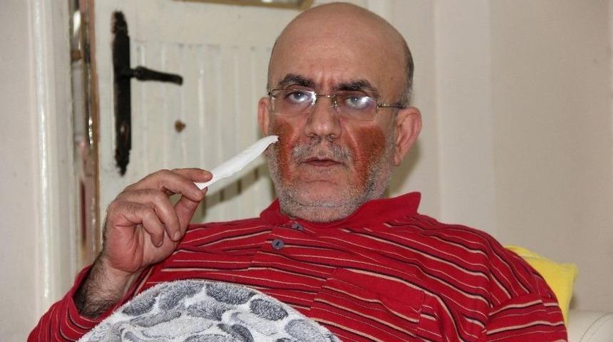 Y&uuml;z&uuml;nde &Ccedil;ıkan Yaralar Nedeniyle G&uuml;nden G&uuml;ne Eriyor