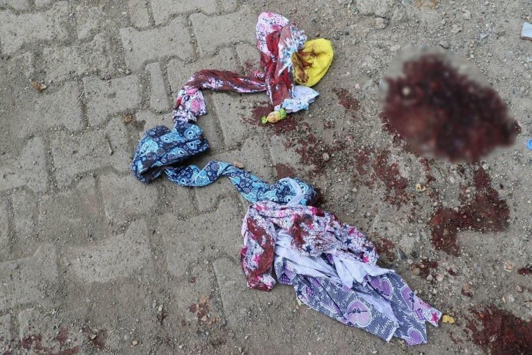 Diyarbakır&rsquo;da Koca Dehşeti: 2 Yaralı