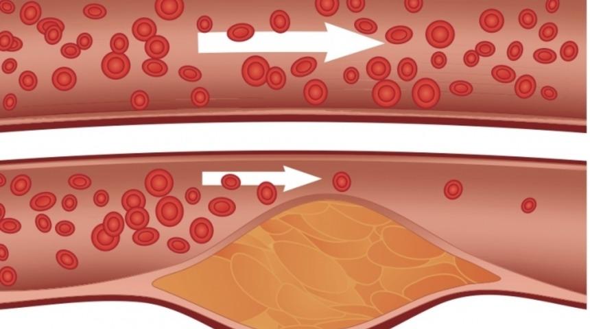 Dereotunun Faydaları Nelerdir?
