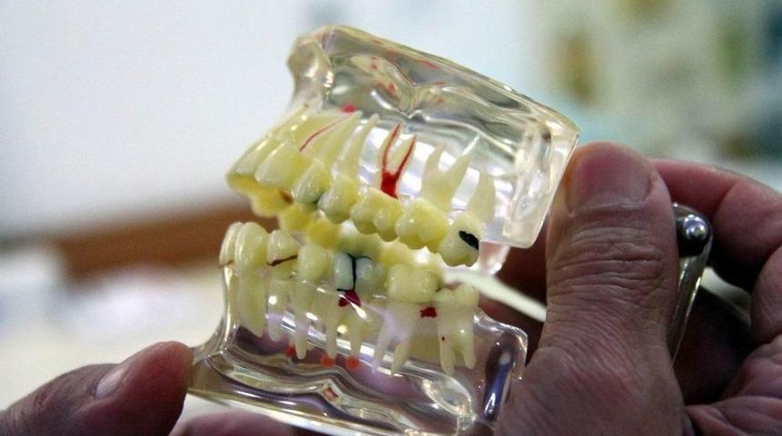 Kırık Dolgu, Diş Kaybına Neden Olabilir