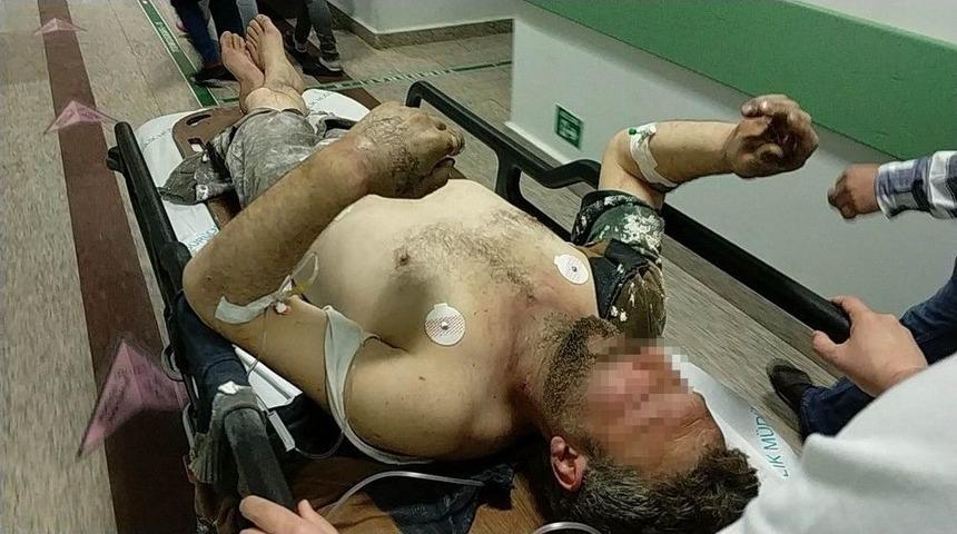 İnşaatta &Ccedil;alışan İş&ccedil;ileri Elektrik &Ccedil;arptı: 2 Yaralı