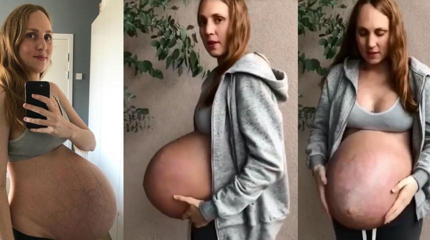 Kopenhag &uuml;&ccedil;l&uuml;s&uuml;! Artık karnını taşıyamaz hale geldi