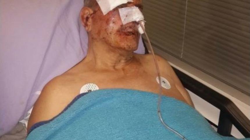 (&ouml;zel Haber) Komşusundan Aidat İstedi Hastanelik Oldu