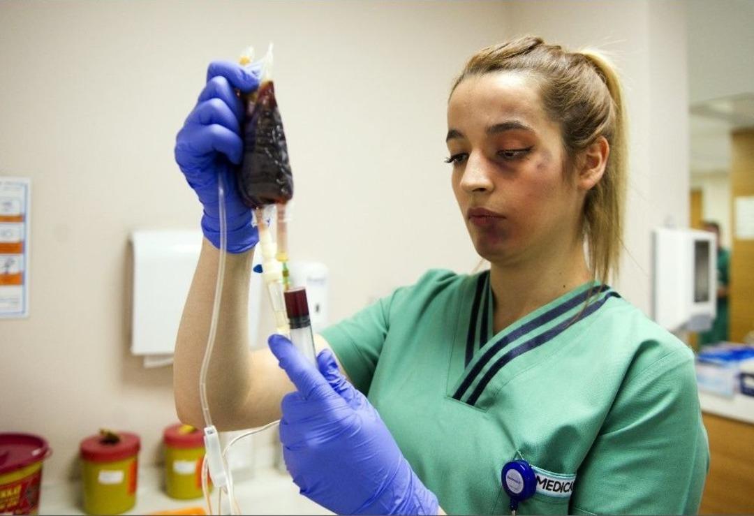 Sağlık &Ccedil;alışanları Y&uuml;zlerine &rsquo;dayak Makyajı&rsquo; Yaparak Şiddete Dikkat &Ccedil;ekti