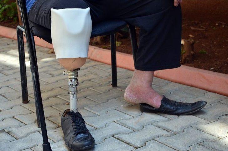 Engelli Vatandaşın “elim, Ayağım, Her Şeyimdi” Dediği Akülü Motoru Çalındı G3