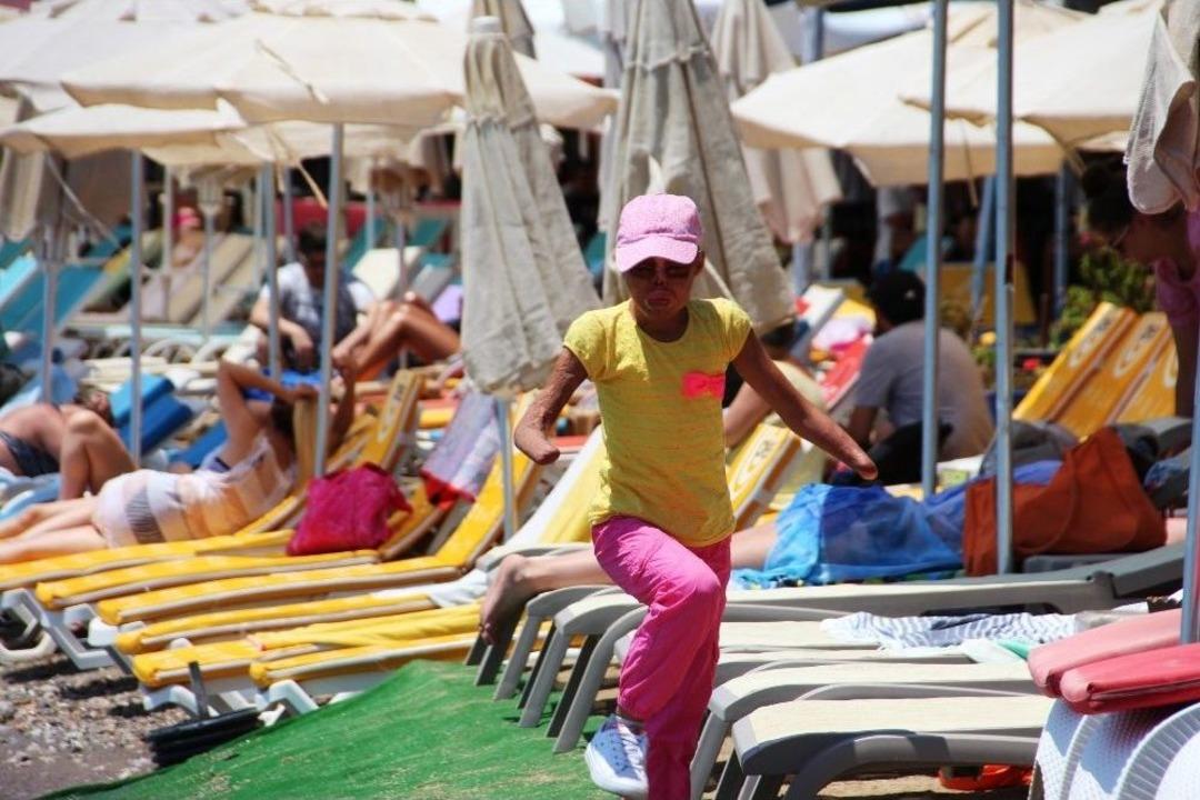 Elleri, Kulakları, Burnu Ve Sa&ccedil;ı Olmayan Minik Zehra&rsquo;nın Tek Hayali Yaşıtları Gibi G&ouml;r&uuml;nmek