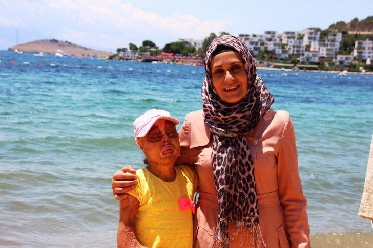 Elleri, Kulakları, Burnu Ve Saçı Olmayan Minik Zehra’nın Tek Hayali Yaşıtları Gibi Görünmek G2