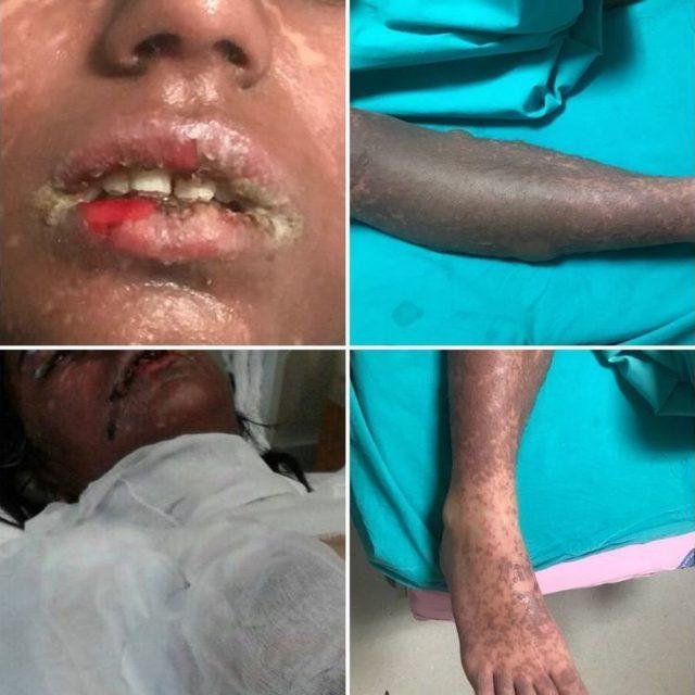 Psikiyatristin Verdiği İla&ccedil;la Yoğun Bakımlık Olan Gen&ccedil; Kızdan Sevindirici Haber 1