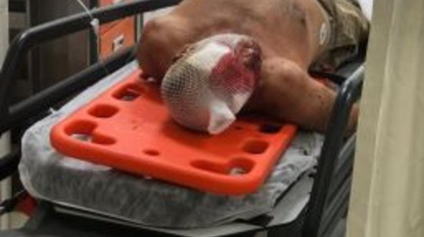 Duran Ara&ccedil; Kapıyı A&ccedil;tı, Seyir Halindeki Motosiklete &Ccedil;arptı: 1 Yaralı