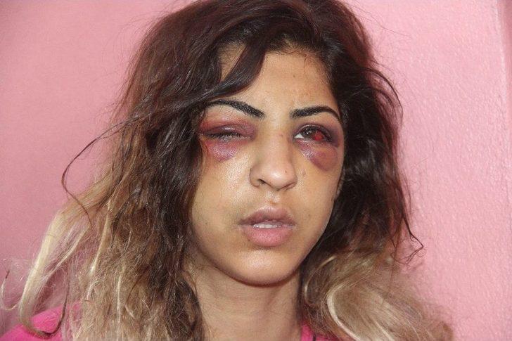 Kuma Getirince Kendisini Terk Eden Eşini 30 Dakika Dövüp Tanınmaz Hale Getirdi G1