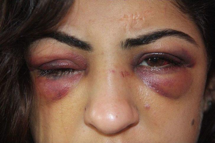 Kuma Getirince Kendisini Terk Eden Eşini 30 Dakika Dövüp Tanınmaz Hale Getirdi G2