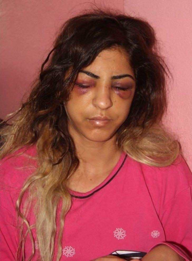 Kuma Getirince Kendisini Terk Eden Eşini 30 Dakika Dövüp Tanınmaz Hale Getirdi G4