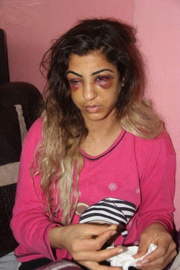 Kuma Getirince Kendisini Terk Eden Eşini 30 Dakika Dövüp Tanınmaz Hale Getirdi G5