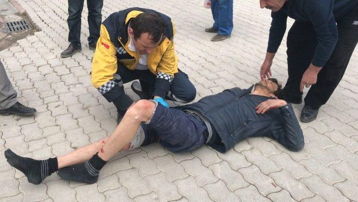 Sokak Ortasında Bacaklarından Vuruldu G2