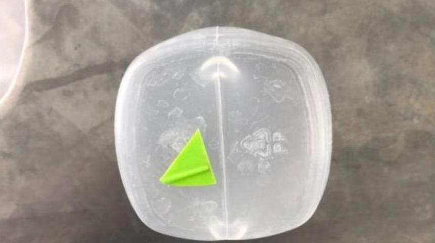 Yuttuğu Oyuncak İle 6 Ay Yaşadı