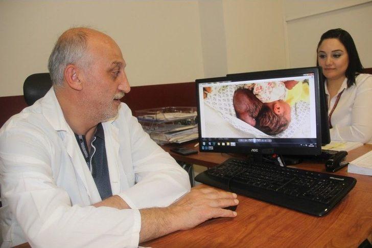 Hatay’da İki Kafalı Bebek Dünyaya Geldi G2