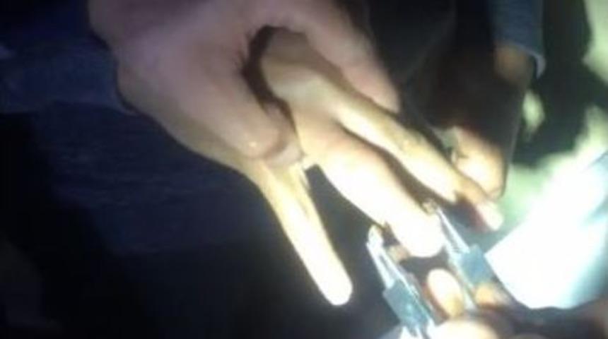 Turistin Parmağına Sıkışan Y&uuml;z&uuml;ğ&uuml; İtfaiye &Ccedil;ıkardı