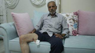 (özel) Bursa’da Pitbull Dehşeti