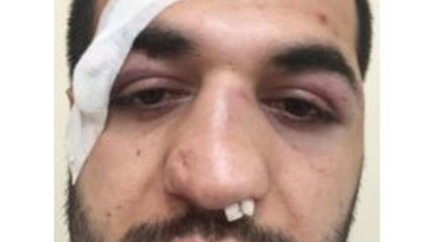 Sokak Kavgasında Sandalyeler Havada U&ccedil;uştu