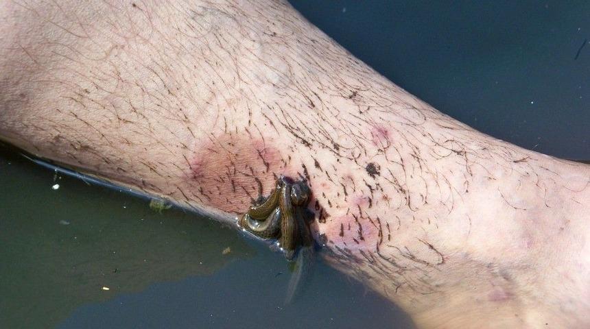 Hassa&rsquo;daki S&uuml;l&uuml;kl&uuml; G&ouml;le Şifa İ&ccedil;in Akın Ediyorlar