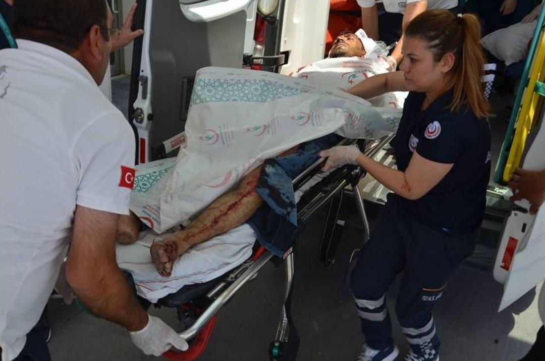 Sokak Ortasında Satırla Yaralandı