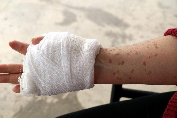 Cilt Kanseri Kadından Bilim Dünyasına Haykırış: “deneylere Katılmak İstiyorum” G4