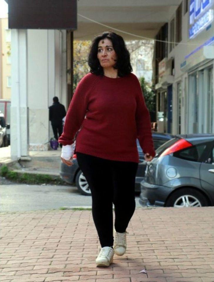 Cilt Kanseri Kadından Bilim Dünyasına Haykırış: “deneylere Katılmak İstiyorum” G2