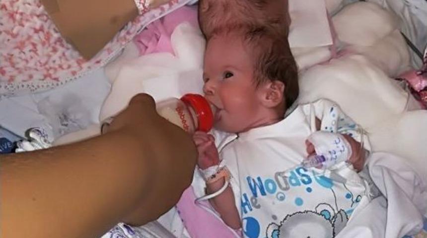 Antalya&rsquo;da Siyam İkizleri Biberonla Beslenmeye Başlandı