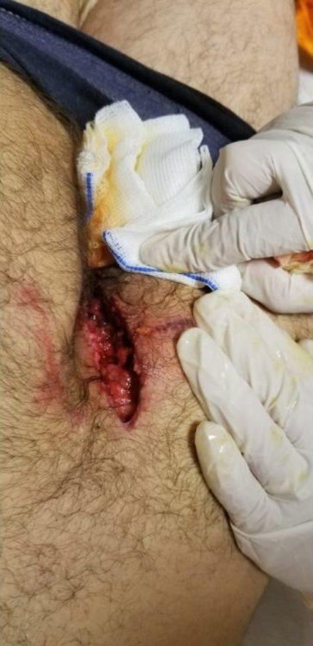 Piknikteki Vatandaşa Ayı Saldırdı 1