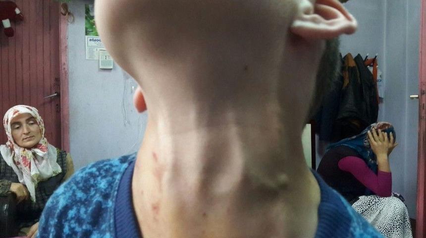 Boğazında Allah Yazan &Ccedil;ocuğu G&ouml;renler Şaşırıyor