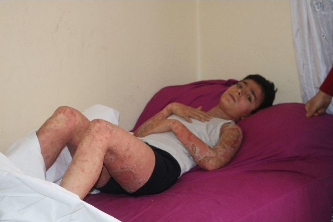 Yaralarından Kurtulmak İ&ccedil;in Tek Umudu Cumhurbaşkanı