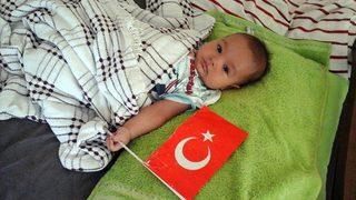 2 Yaşındaki Hasan’a Umut Arayışı