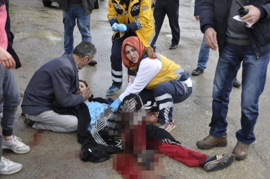 Boşanmak &Uuml;zere Olduğu &Uuml;&ccedil; Aylık Hamile Eşini Pompalı T&uuml;fekle Yaraladı