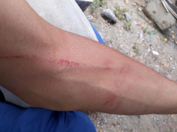 Hatay’da Hatsu Personelinin Vatandaşı Darp Ettiği İddiası G4