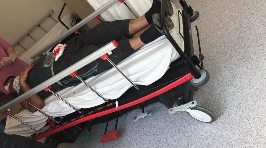 Patlayan Lastik Tamirciyi Hastanelik Etti