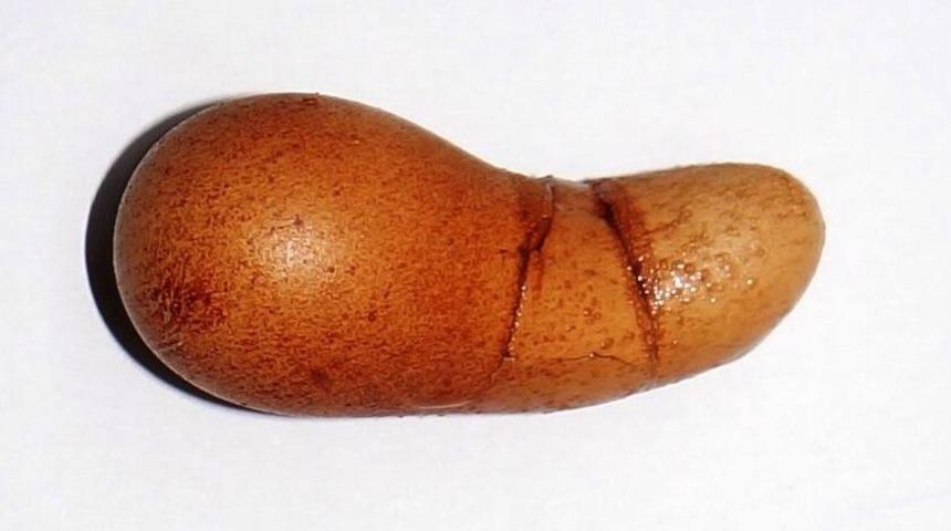 Sarıg&ouml;l&rsquo;de G&ouml;renleri Şaşırtan Yumurta