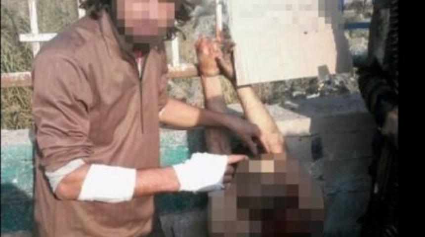 Deaş&rsquo;ın Celladı Şanlıurfa&rsquo;da Yakalandı