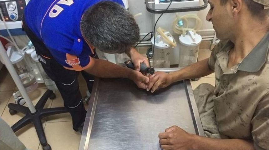 Parmağını Arı Soktu, Sıkışan Y&uuml;z&uuml;k Kesilerek &Ccedil;ıkartıldı