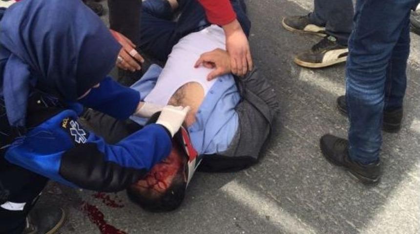 Otomobilin &Ccedil;arptığı Suriyeli Baba Ve Kızı Ağır Yaralandı