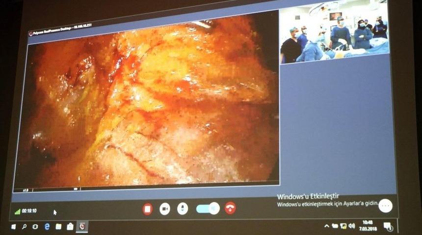 Yozgat&rsquo;ta İlk Kez İnteraktif Katılımla Kasık Fıtığı Ameliyatı Yapıldı