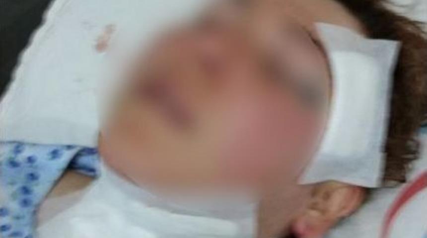 Kadınlar G&uuml;n&uuml;&rsquo;nde Vahşet