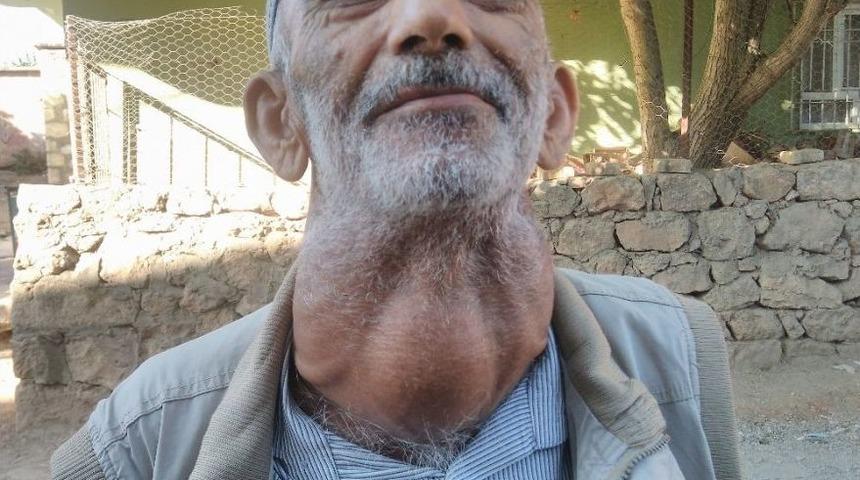 Ameliyattan Korktuğu İ&ccedil;in 30 Yıldır Kitle İle Yaşıyor